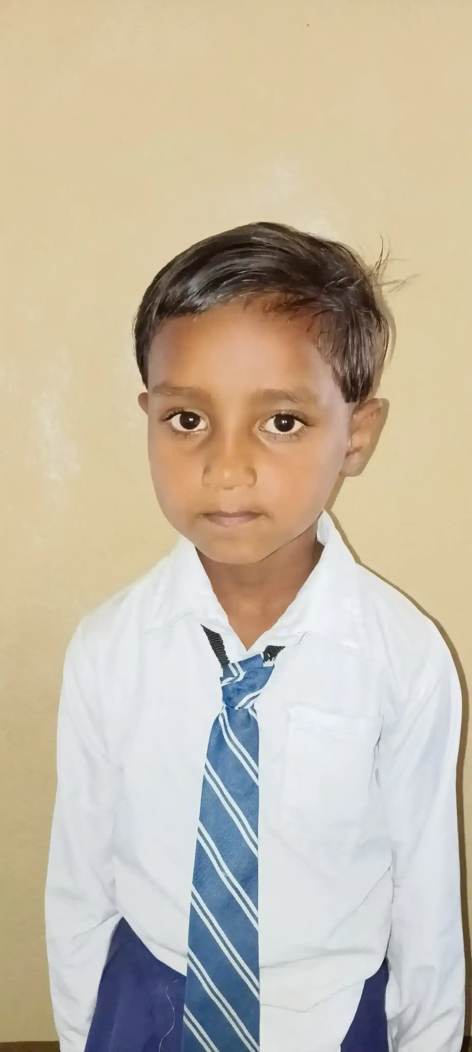 ANUSHKA KUMARI(R.T.E)